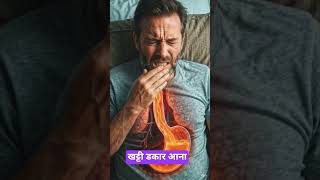 बार-बार खट्टी डकार आने का असली कारण#shorts#ytshorts#3danimation khattidakar#