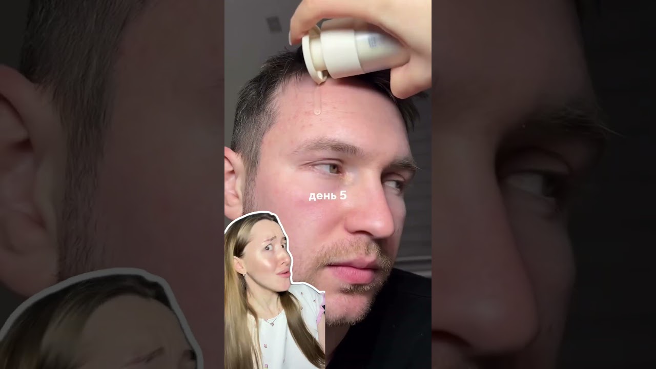 Сыворотка на вб - 