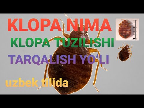 Video: Klişe Nima?