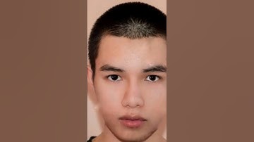 Remove pimples from face with Snapseed app #subscribe #editing #viral #mobilephotograph