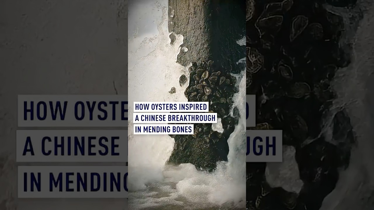 How oysters inspired a Chinese breakthrough in mending bones
