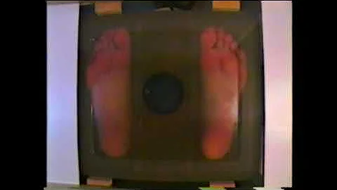 Ion Cleanse foot bath exposed