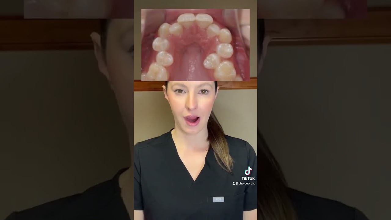 What age should you get your child evaluated for orthodontic treatment? ￼