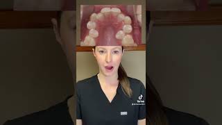 What age should you get your child evaluated for orthodontic treatment? ￼