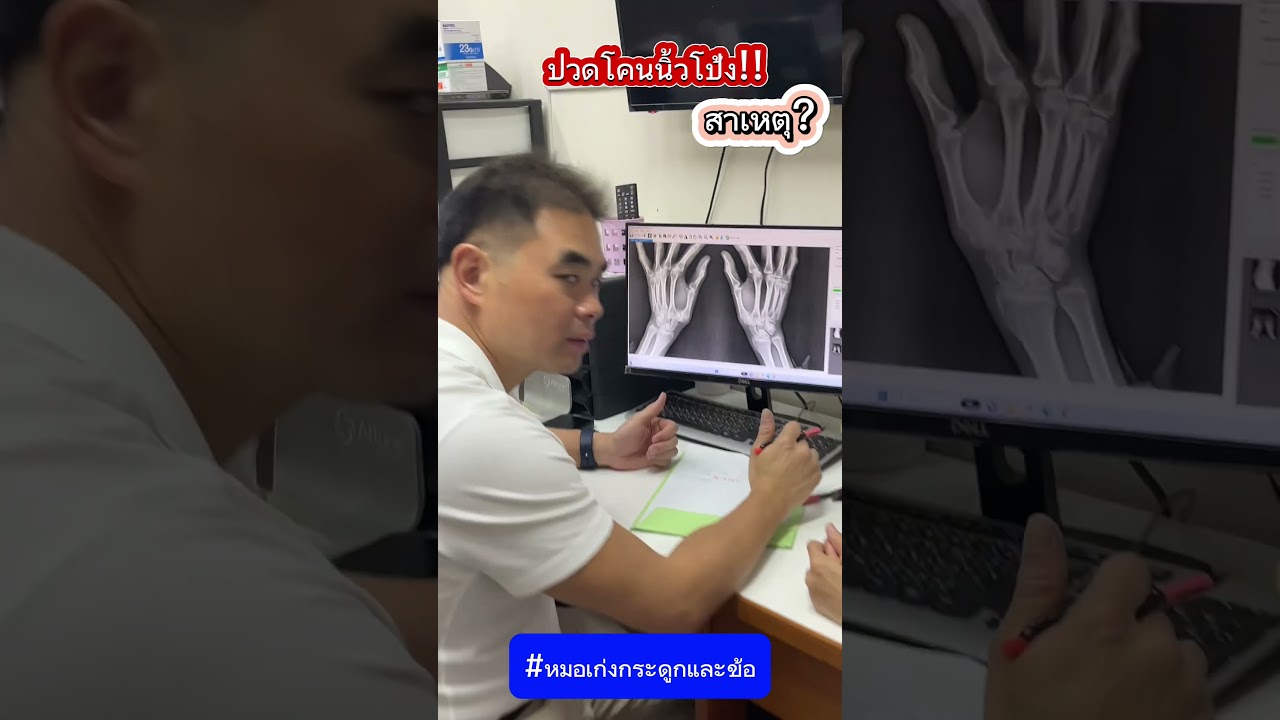 ปวดโคนนิ้วโป้ง สาเหตุ? #หมอเก่งกระดูกและข้อ #ปวดโคนนิ้วโป้ง #ข้อเสื่อม