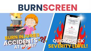 AI Burn Injury Detection Website Using TensorFlow.js | BurnScreen [2026]