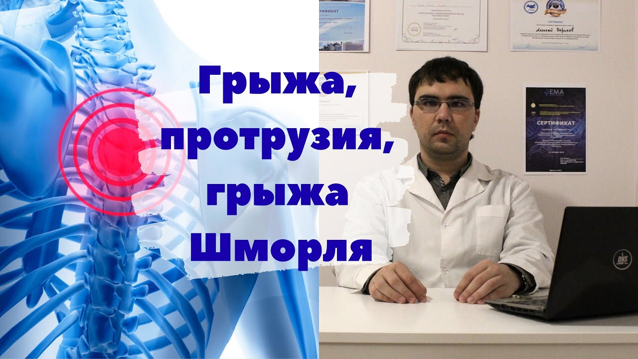 Грыжа, протрузия межпозвонкового диска, грыжа Шморля: в чем же разница?