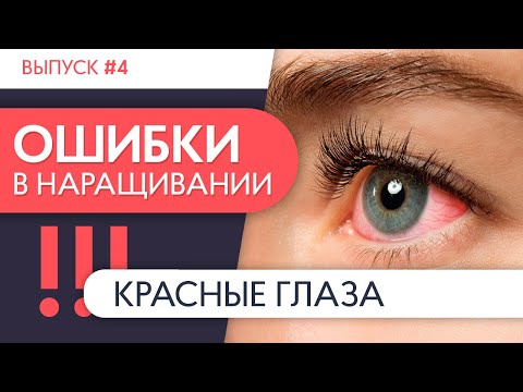 КРАСНЫЕ ГЛАЗА | Ошибки в наращивании ресниц. Выпуск №4