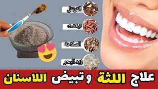 وصفة طبيعية️ لتبيض الاسنان و علاج نزيف اللثة‼️ ومحلول قوي لتنظيف وتطهير الفم?