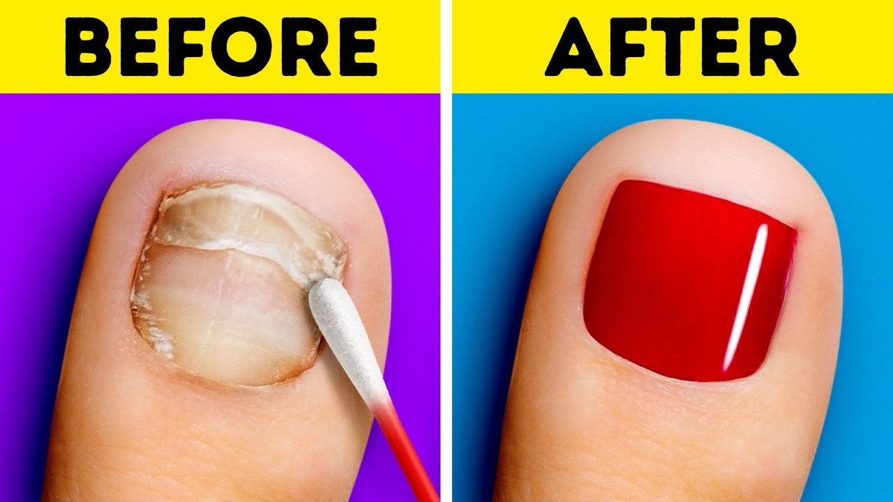 Fast Feet Transformation || Amazing Manicure and Pedicure Techniques