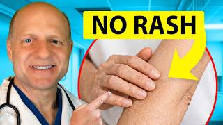 10 Dangerous Causes of ITCHING You Should Never Ignore – Doctor Explains