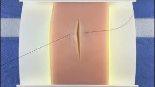 Horizontal Mattress Suture