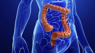 Current Research on Abdominal Cocoon Syndrome: Two Cases of an Anatomical Abnormality