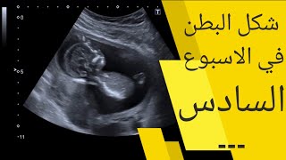 شكل البطن في الاسبوع السادس من الحمل | متي انتفاخ بطن الحامل في الشهر الأول