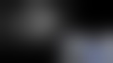 EUS sampling of submucosal lesion (suspected GIST)