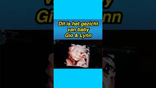 😯👶 Dit is het gezichtje van baby Gio &amp; Lynn #vlog #baby #gio