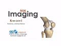 التصوير بالرنين المغناطيسي للركبة Knee MRI