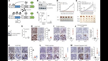 Three -way ANOVA in Completely randomized design in R (using ExpDes package)