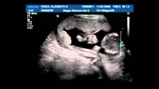 Baby Sonogram