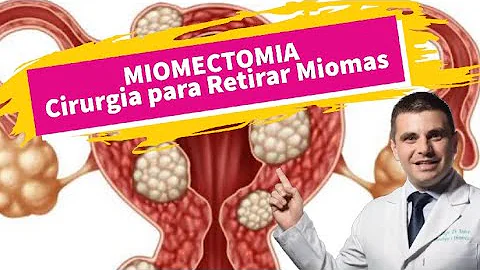 Como tirar um mioma intramural?