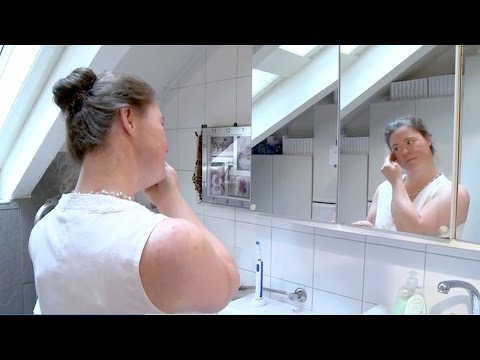 Video: NLRP3 E311K-Mutation In Einer Großen Familie Mit Muckle-Wells-Syndrom - Beschreibung Eines Heterogenen Phänotyps Und Ansprechen Auf Die Behandlung