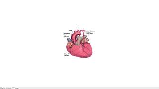 Cad and angina surgery treatments