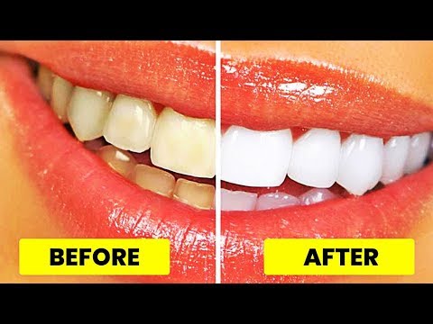 top-5-simple-ways-to-naturally-whiten-your-teeth-at-home-overnight