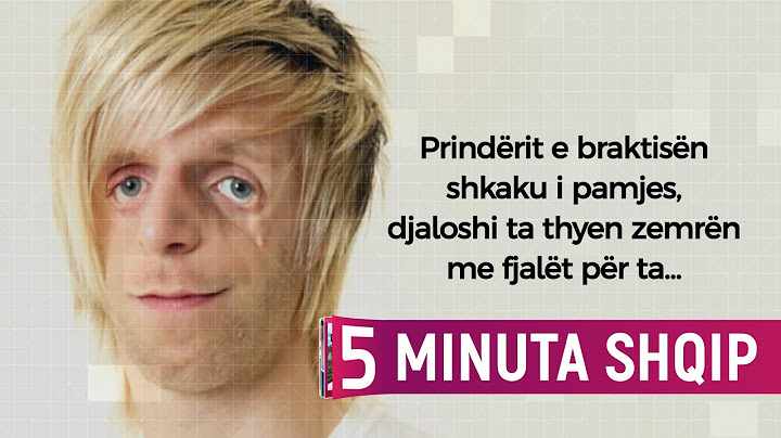 Prindërit e braktisën pasi lindi shkaku i pamjes, por ajo që thotë ky djalë të thyen zemrën...