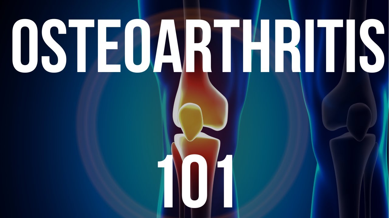 Osteoarthritis 101 (Cause, Diagnosis, Imaging, Treatment)
