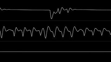 NecroPolo - "Robooty (C64)" [Oscilloscope View]