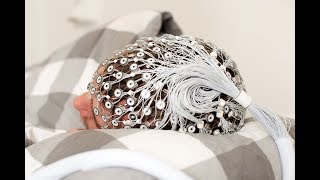 Onderzoek Naar Hersenmechanismen Van Slapeloosheid - Eus Van Someren