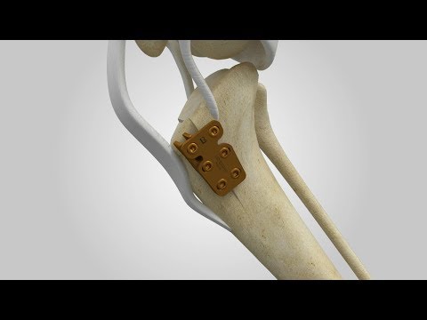 Video: Ontwrigting Van Knieskyf By Honde - Patellar Luxation In Dogs