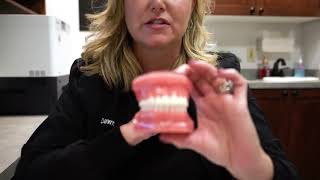 What are Turbo Bites and How We Use Them at Cook Orthodontics of Dublin