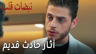 مسلسل نبضات قلب الحلقة 19 - آثار حادث قديم