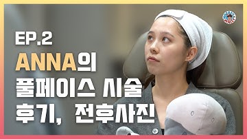 ANNA의 첫 한국 피부과시술  Ep 2.  이마필러, 턱필러,  팔자필러, 코필러 , 입술필러 전 후 공개 !