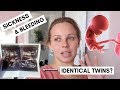 8-12 PREGNANCY UPDATE | TWINS | IDENTICAL OR NON? | Lucy Jessica Carter