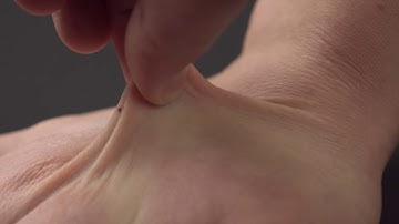 How to conduct a skin elasticity test