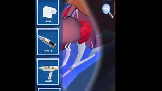 Spleen Remove Surgery 🩺💯🏥... #surgery #surgeryhub screenshot 5
