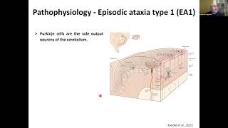 Research and Treatment Development for Episodic Ataxia