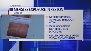 Measles exposure reported in Reston: Health officials