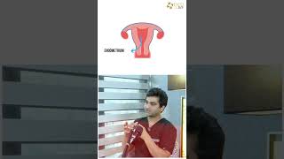 Good Embryos, No Pregnancy? Here's Why! Dr Rhythm Gupta - IVF specialist at Excel IVF