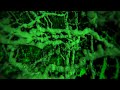 Journey into an swollen brain