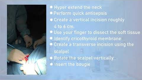 scalpel bougie technique