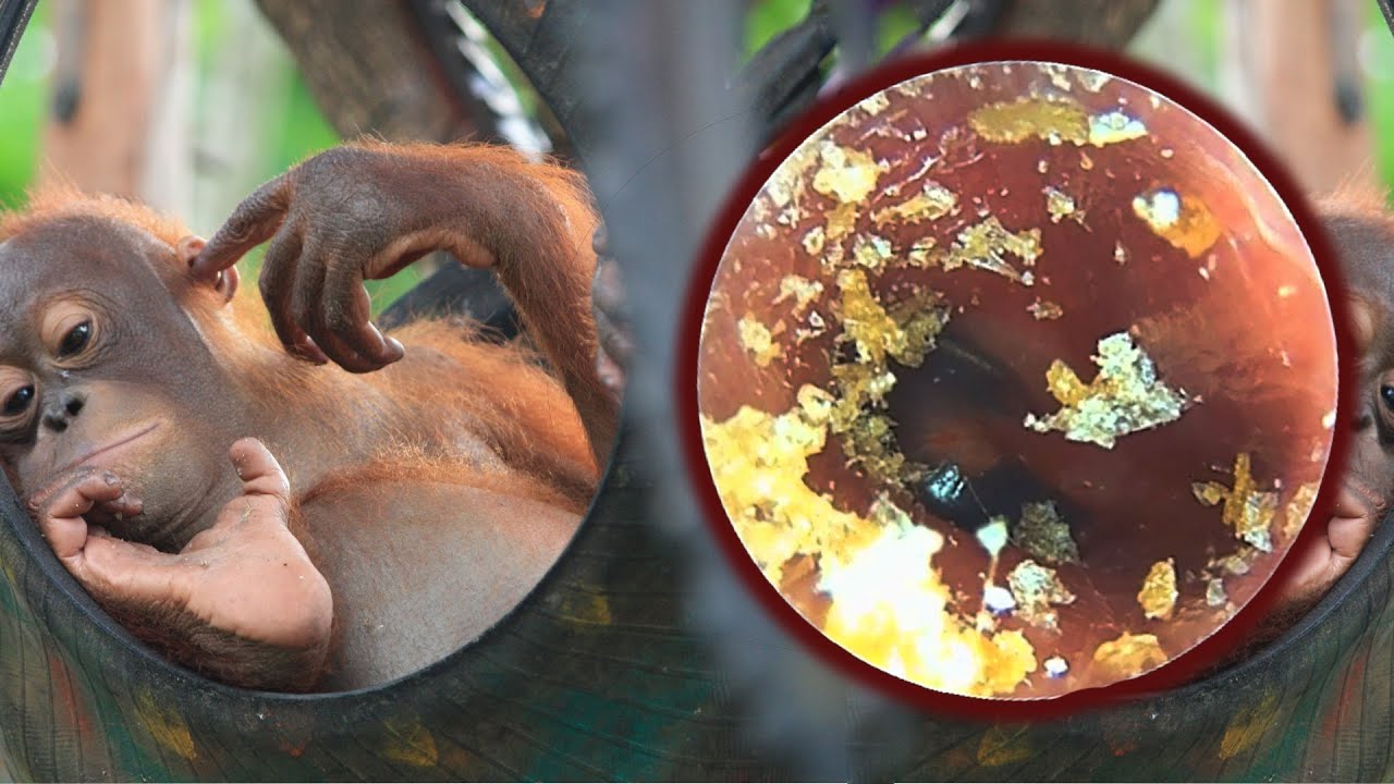 耳垢除去銃 ear wax removal gun part 414 YouTube