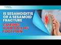 Is sesamoiditis or a sesamoid fracture causing your ball of foot pain