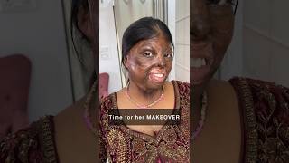 Burn survivor makeup tutorial #shorts #ytshorts #makeupclasses