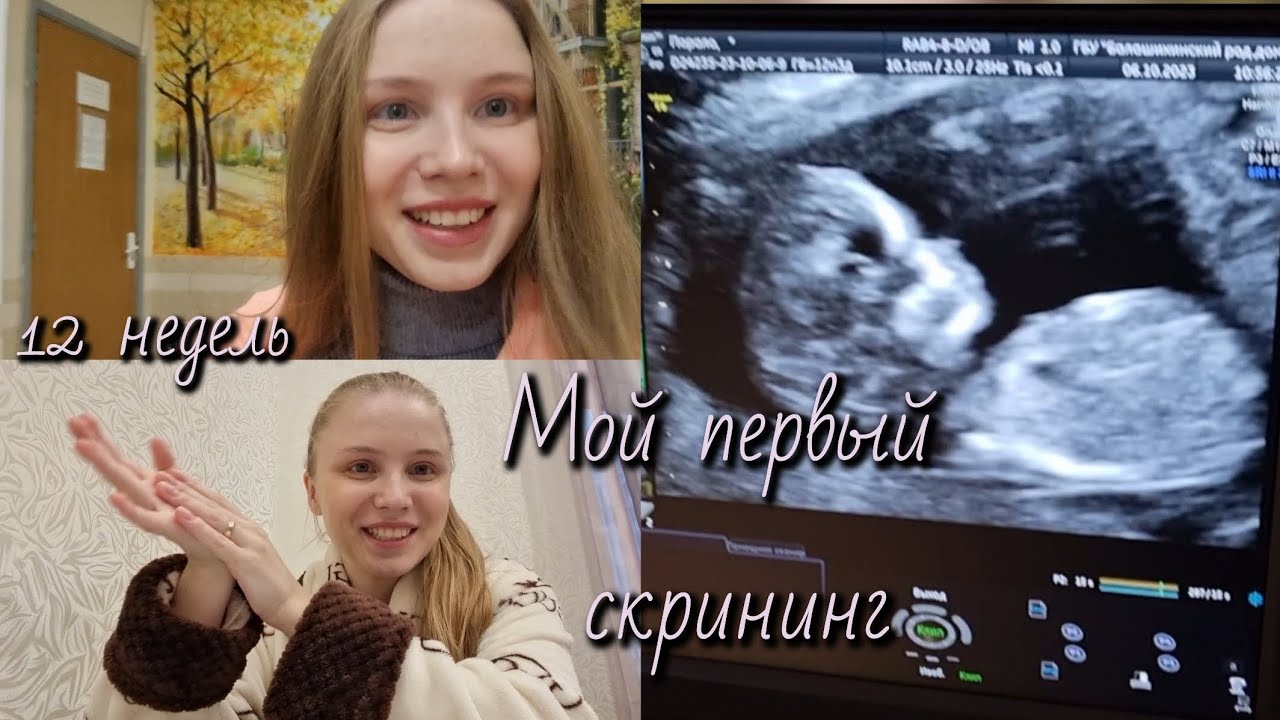 Первый скрининг🤰/12 недель беременности 💞 - YouTube