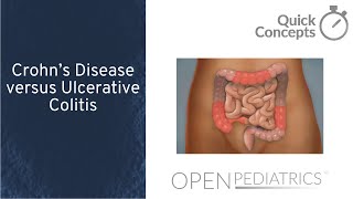 Crohn's Disease versus Ulcerative Colitis by J. Ouahed, L. Collen | OPENPediatrics
