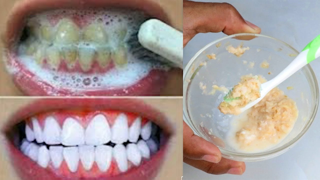 How to whiten your teeth In 3 minutes with ginger and salt YouTube