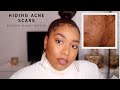 Everyday Makeup Routine | How I Cover my Acne Scars